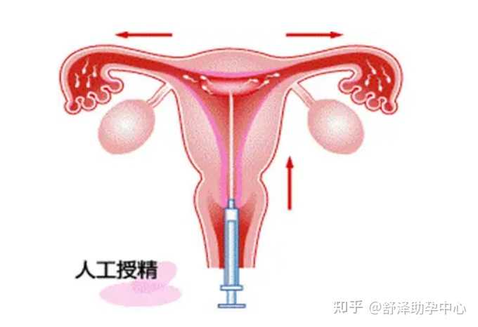 广东省试管助孕机构排行榜前十最新发布！广州试管医院排名前十推荐